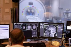 Inteligența artificială, folosită în operațiile pe creier. Neurochirurgii îmbrățișează inițiativa