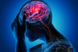Ziua Mondială a Accidentului Vascular. Peste 60.000 de români suferă un AVC anual