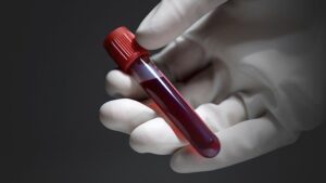 FDA a aprobat un medicament pentru tratarea cancerului de sânge