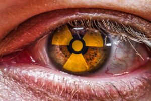 Nivelul de poluare al aerului este ridicat, iar asta ne afectează ochii