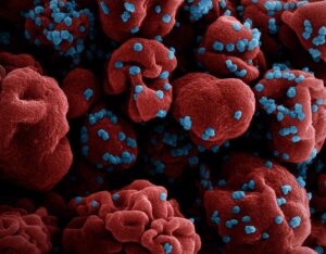 Există o creștere semnificativă a cazurilor de infecție