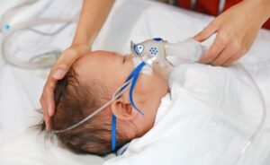 Virusul sincițial respirator poate duce la complicații grave