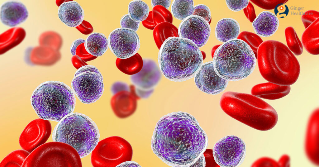 28 Mai este declarată Ziua Mondială a Cancerului de Sânge