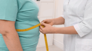 Gradul de obezitate din România a ajuns la 34%